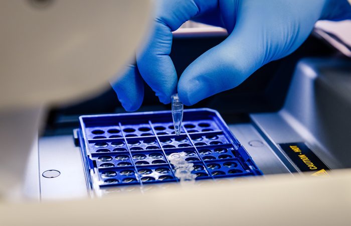 Polymerase Chain Reaction