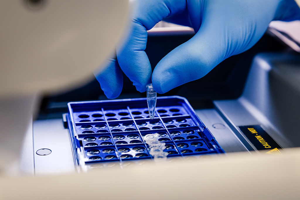 Polymerase Chain Reaction