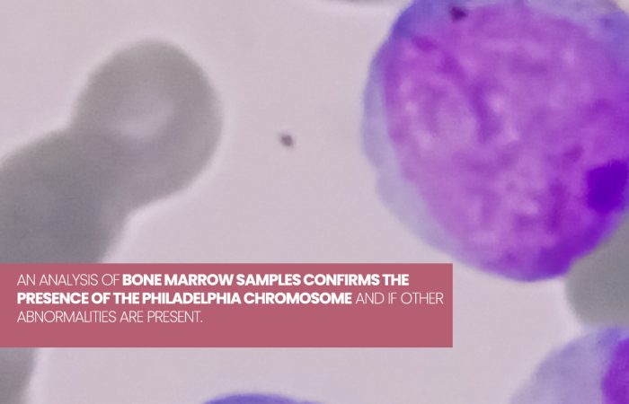 CML, Bone Marrow Biospy